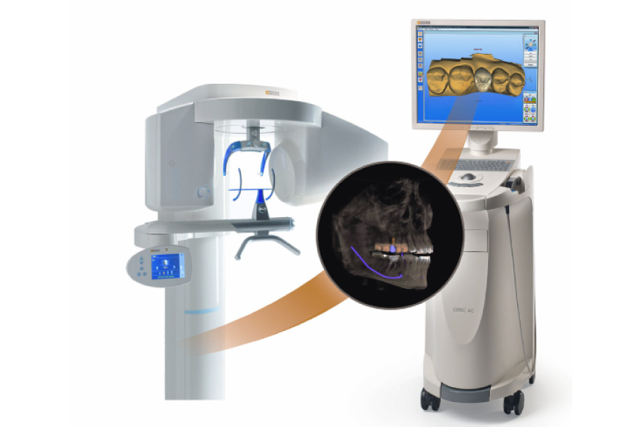 Cartoon image of the CEREC same-day crown technology 