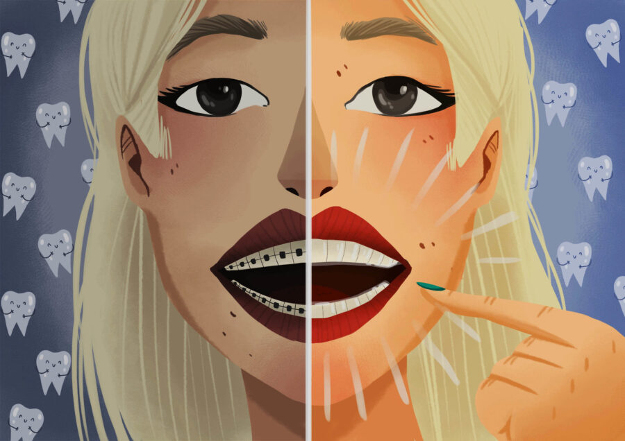 Graphic illustration of woman comparing traditional braces vs Invisalign clear aligners.